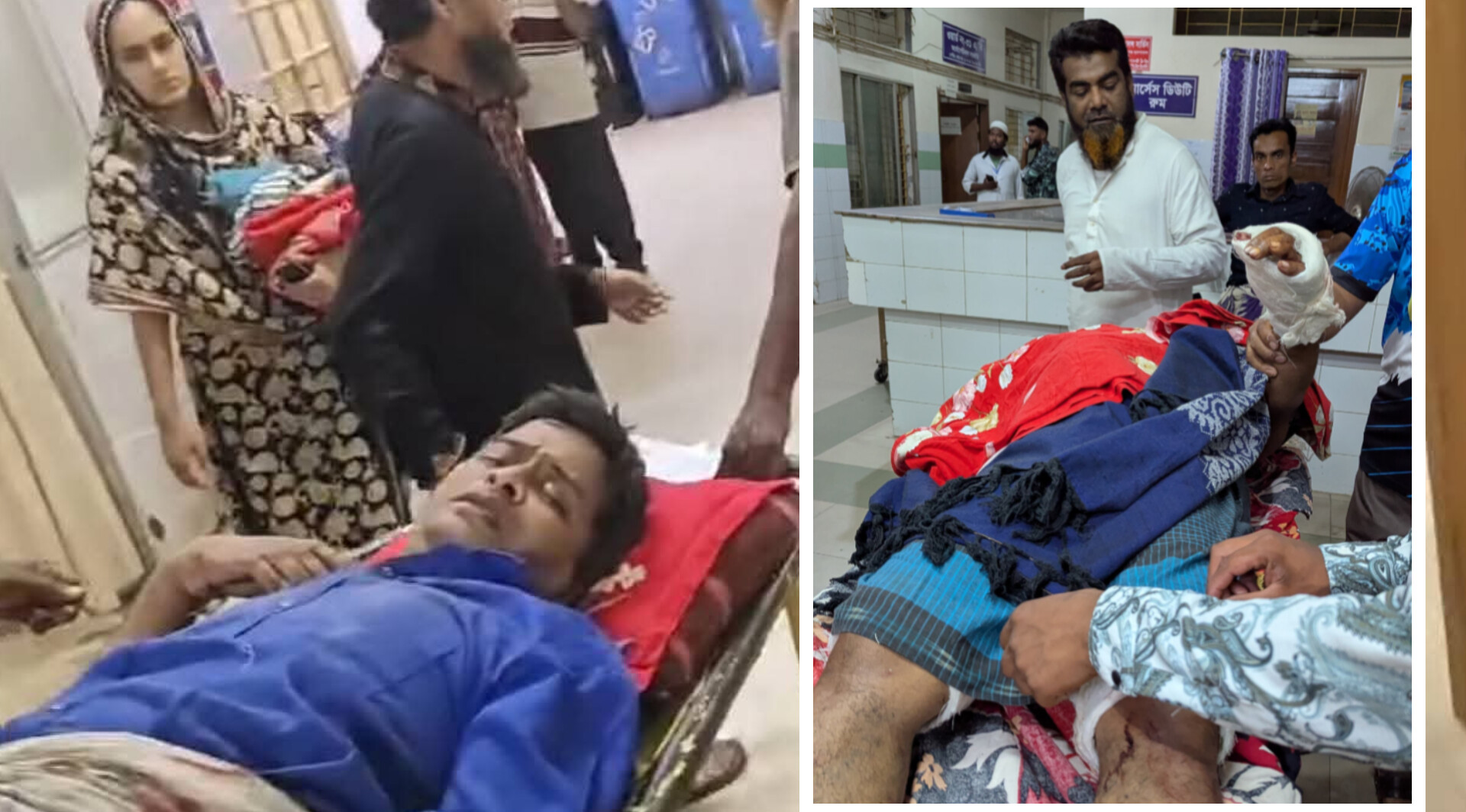 চুরি মামলা তুলে না নেয়ায় সাংবাদিককে কুপিয়ে জখম-আঙুল বিচ্ছিন্ন