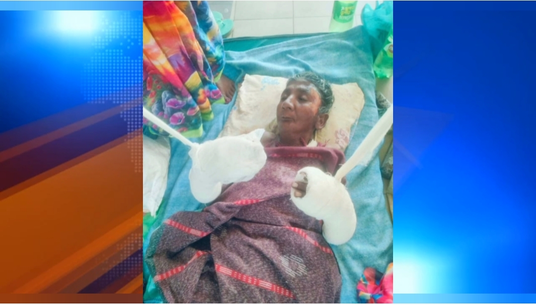 কয়েলের আগুনে পুড়ল  গরু বাঁচাতে গিয়ে দগ্ধ বৃদ্ধা